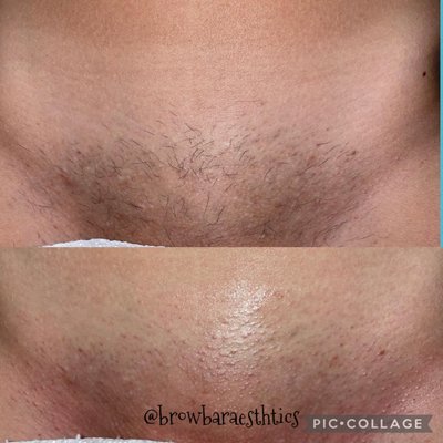 The Brow Bar Aesthetics - Welcome to “Brow Bar Aesthetics” where we specialize in full body waxing for both men and women including the following; eyebrow waxing/tint, full legs , (P)Brazilian & brow lamination & so much more. My goal is to always aim to provide quality service to my clients. Thank you in advance for choosing “BBA” to be apart of your beauty lifestyle.
