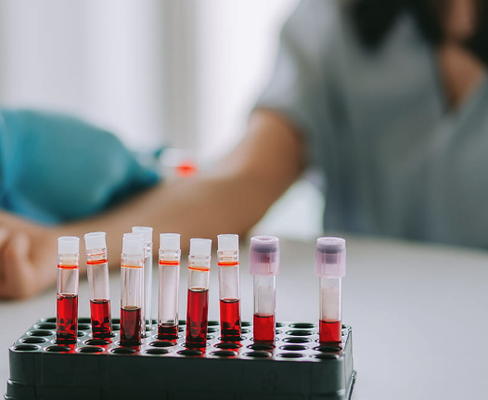 Blood Draws - Blood draws involve collecting a blood sample from a vein, typically for medical testing, diagnosis, or monitoring health conditions. Blood Draws - Blood draws involve collecting a blood sample from a vein, typically for medical testing, diagnosis, or monitoring health conditions.