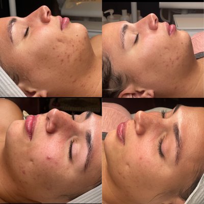 Before and Afters of my Services! - I offer everything from eyebrow waxing & tinting, lash lifts & tints, and SO many customizable facials! Take a look at some of my clients before and afters and give me a call to book an appointment with me:)! Before and Afters of my Services! - I offer everything from eyebrow waxing & tinting, lash lifts & tints, and SO many customizable facials! Take a look at some of my clients before and afters and give me a call to book an appointment with me:)!