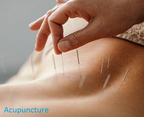 Our Services - A list of some of the services provided at our office. Please visit https://www.myirvineacupuncture.com/ for a full list and for more details regarding each. Our Services - A list of some of the services provided at our office. Please visit https://www.myirvineacupuncture.com/ for a full list and for more details regarding each.