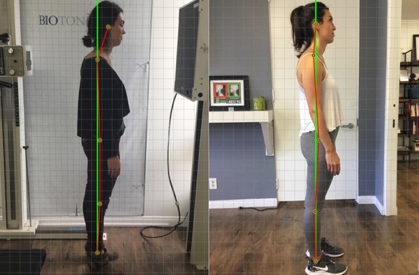 Before and Afters - All patients were treated with Chiropractic Biophysics protocol which include corrective spinal tractions, mirror image exercises and adjustments and spinal decompression when necessary. Before and Afters - All patients were treated with Chiropractic Biophysics protocol which include corrective spinal tractions, mirror image exercises and adjustments and spinal decompression when necessary.