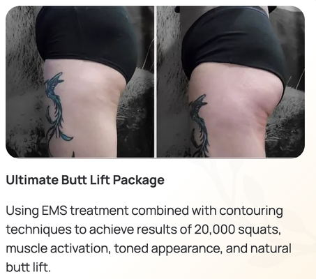 Body Sculpting - Reduce stubborn fat and tighten skin without surgery! Reveal a more sculpted, toned, and confident version of yourself with our advanced body contouring treatments. Designed to reduce fat, tighten skin, and enhance muscle tone—without surgery or downtime—our non-invasive sessions in Springfield, MA help you feel great in your body again. Body Sculpting - Reduce stubborn fat and tighten skin without surgery! Reveal a more sculpted, toned, and confident version of yourself with our advanced body contouring treatments. Designed to reduce fat, tighten skin, and enhance muscle tone—without surgery or downtime—our non-invasive sessions in Springfield, MA help you feel great in your body again.