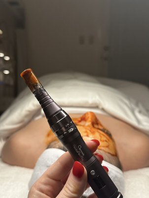 Anti-Aging Facial Infusion - A medical grade anti-aging treatment full of nutrients and antioxidants for your skin to soak up and resurrect itself into its healthiest form. This treatment contains Retinaldehyde which is 1,000 times more potent and anti-aging than retinol! This  Infusion is worked in through a process called micro-channeling which penetrates the ingredients 600% deeper. A professional grade enzyme mask, lymphatic drainage, extractions, and customizable mask will also be added to this treatment. This is a non-sensitizing and no downtime peel; your skin will radiate immediately with no peeling and little to no sensitivity. Because this generates a 30 day collagen and fibroblast production increase, this treatment is only needed every 30 days. Let's rewind time and get you to your dream skin!