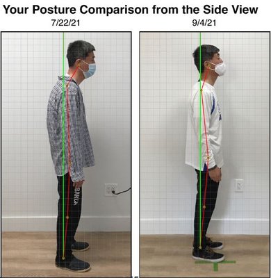 Posture Correction - We specialize in corrective chiropractic care designed to provide long-term pain relief and restore your body’s natural alignment.
