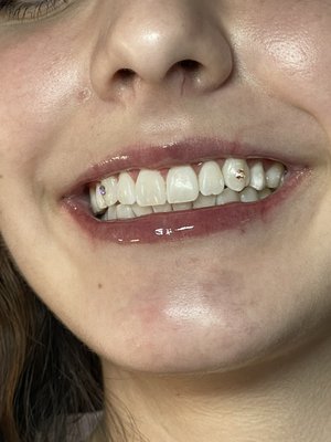 Tooth Gems - Let me enhance your smile ✨ bling you out Tooth Gems - Let me enhance your smile ✨ bling you out
