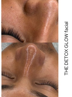 THE DETOX GLOW facial - We don’t just cleanse — we go deep.
Cleared congested pores, extracted buildup, and left the skin smooth, fresh, and glowing.
Squeaky-clean pores are just one click away.
Book online now and take advantage of our limited grand opening promo!!!!