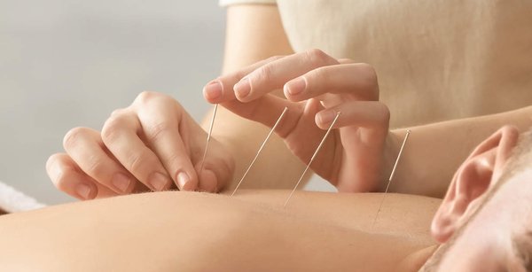 What is Acupuncture and how it works? - Acupuncture has over 3000 years of history and has been primary medical treatment way in most of the Asia countries and Europe. The acupuncture needle stimulates the Cranial Nerve System(CNS) and promotes the secretion of the hormones. Acupuncture helps your body to work properly by itself without any chemical invasion.