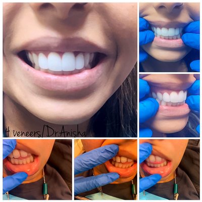 ANISHA NGUYEN, DDS - MILE SQUARE PARK FAMILY DENTAL GROUP - Updated May ...