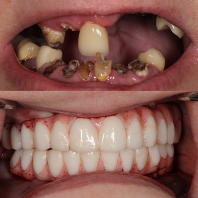 SMILE MAKEOVERS - Unlock the full potential of your smile with our comprehensive smile makeover services. Our expert dental team is committed to crafting a smile that not only looks stunning but also reflects your unique personality and boosts your confidence. SMILE MAKEOVERS - Unlock the full potential of your smile with our comprehensive smile makeover services. Our expert dental team is committed to crafting a smile that not only looks stunning but also reflects your unique personality and boosts your confidence.