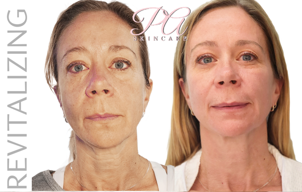 SQT Bio Micro-needling - Introducing a revolutionary, NEEDLE FREE SQT Bio Microneedling. Safe for all skin types, tones. No blood, no skin breakage. Visible results 7 days after 1st treatment. Revitalizing. Resurfacing. Rejuvenating. SQT Bio Micro-needling - Introducing a revolutionary, NEEDLE FREE SQT Bio Microneedling. Safe for all skin types, tones. No blood, no skin breakage. Visible results 7 days after 1st treatment. Revitalizing. Resurfacing. Rejuvenating.
