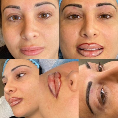 Ronda - New lip liner along with eyebrow color restoration and a touch of Microblading and Ombré on brows. Ronda - New lip liner along with eyebrow color restoration and a touch of Microblading and Ombré on brows.