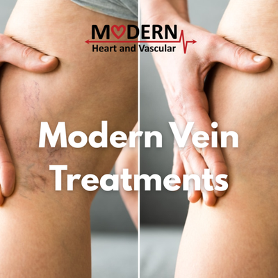 Modern Vein Treatments - Minimally invasive solutions for healthy, comfortable legs—helping you move and feel your best. Modern Vein Treatments - Minimally invasive solutions for healthy, comfortable legs—helping you move and feel your best.