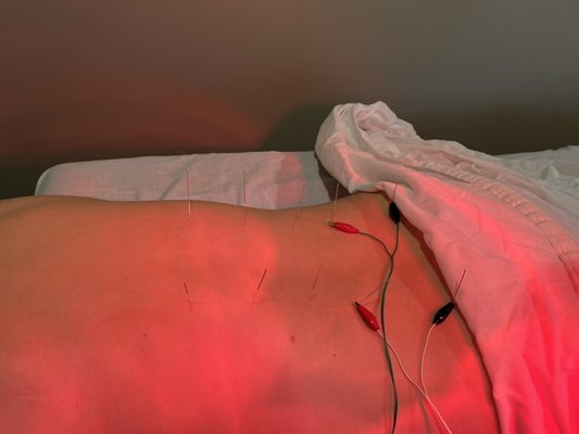 Back pain specialist - We treat your chronic back pain. Within a few sessions, you will be pain free