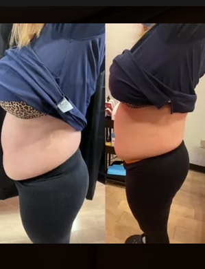 Body Contouring - We have Customized packages just for you &
with a successful referral you will receive a
FREE Session!
- Beach Body Belly Buster(for men and women)
- Bum Lift
- Breast Lift
- Cellulite Removal
- Sauna wraps and more!
Bridal Party / Group sessions also available.
Call ahead to book an appointment Body Contouring - We have Customized packages just for you &
with a successful referral you will receive a
FREE Session!
- Beach Body Belly Buster(for men and women)
- Bum Lift
- Breast Lift
- Cellulite Removal
- Sauna wraps and more!
Bridal Party / Group sessions also available.
Call ahead to book an appointment