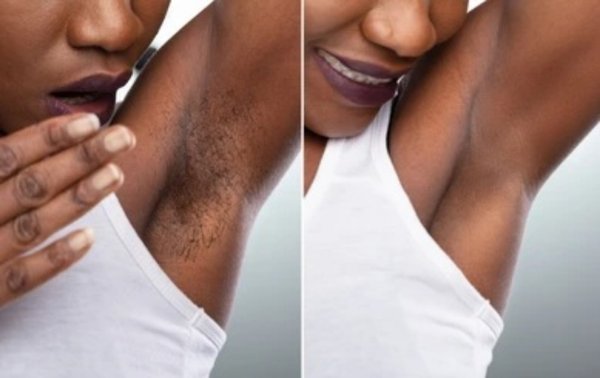 Sugaring - Waxing is the best hair removal technique. Whether you choose Sugar or Hard Wax you treat your skin better by avoiding razors Sugaring - Waxing is the best hair removal technique. Whether you choose Sugar or Hard Wax you treat your skin better by avoiding razors