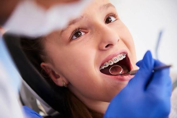 Braces for Children - Our orthodontic team helps children achieve healthy, beautiful smiles while guiding the growth and development of their teeth and jaws.  Our personalized treatment plans are designed to create healthy bites, beautifule smiles and confidence that lasts a lifetime.