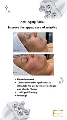 Classic Anti-Aging Facial - Non-Surgical skin tightening with our Venus Legacy™ to soften fine lines & wrinkles. Classic Anti-Aging Facial - Non-Surgical skin tightening with our Venus Legacy™ to soften fine lines & wrinkles.