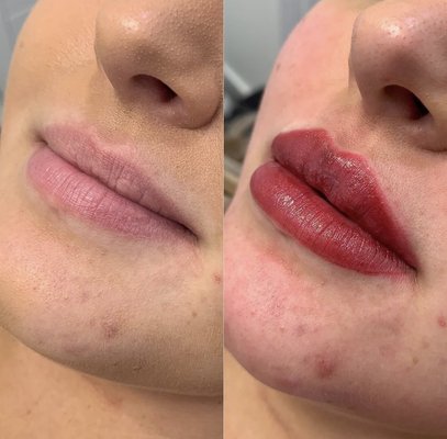 Lip Blushing - Lip blushing is a permanent makeup technique that implants pigment into the lips to enhance natural color and optimize a natural sensual shape Lip Blushing - Lip blushing is a permanent makeup technique that implants pigment into the lips to enhance natural color and optimize a natural sensual shape
