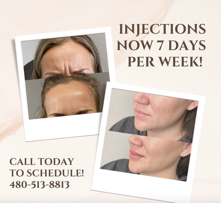 CLINICAL INJECTIONS - Services include, but not limited to are:
Neuromodulators: Botox/ Dysport
Hyaluronic Acid Dermal Fillers: Cheeks, Jawline, Nasolabial Fold, Lip Augmentation
5-Year Dermal Filler-Bellafill: Cheeks, Jawline, Nasolabial Fold
PRP Treatments: Under-Eye Correction, Hair Restoration, Facial Injections, Acne Scar Revision, Wrinkle Reduction
Health Injections: B12, Fat Burner, Custom IV Therapy CLINICAL INJECTIONS - Services include, but not limited to are:
Neuromodulators: Botox/ Dysport
Hyaluronic Acid Dermal Fillers: Cheeks, Jawline, Nasolabial Fold, Lip Augmentation
5-Year Dermal Filler-Bellafill: Cheeks, Jawline, Nasolabial Fold
PRP Treatments: Under-Eye Correction, Hair Restoration, Facial Injections, Acne Scar Revision, Wrinkle Reduction
Health Injections: B12, Fat Burner, Custom IV Therapy