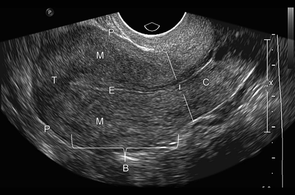 Trans Vaginal Ultrasound - Complete Trans-Vaginal Diagnostic Solutions.