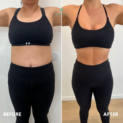Weight Loss | Before + After - At Epiphany Medspa and Wellness, we offer both Semaglutide and Tirzepatide for weight loss. We offer different packages depending on your weight goal. Both plans come with meal and fitness plan. Following the guide, patients have lost anywhere from 3-9lbs their first week. Weight Loss | Before + After - At Epiphany Medspa and Wellness, we offer both Semaglutide and Tirzepatide for weight loss. We offer different packages depending on your weight goal. Both plans come with meal and fitness plan. Following the guide, patients have lost anywhere from 3-9lbs their first week.