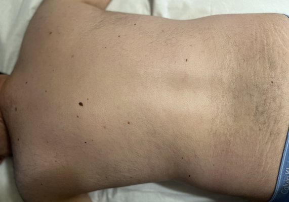 Men’s Back Wax - Mens Before/After Back Wax
