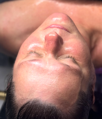 Hydra Facial - Experience the ultimate skin rejuvenation with Hydrafacial—your secret to a glowing complexion in just 30 minutes!

All my Facials come with extractions🥰