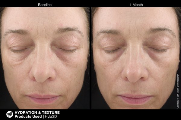 Jan Marini Skincare - Examples of skin improvement with profession at home skin care. Jan Marini Skincare - Examples of skin improvement with profession at home skin care.