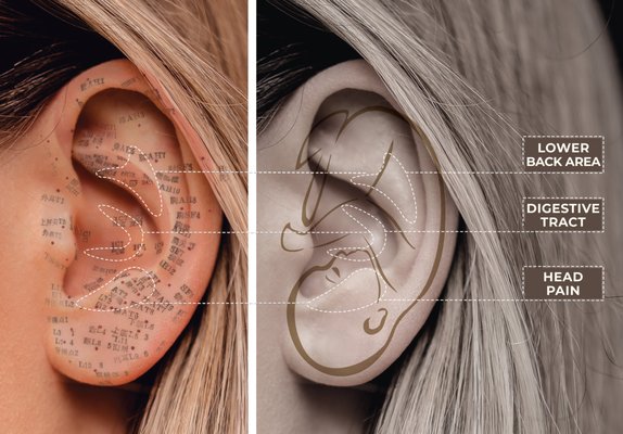 Acupuncture & Auricular (ear) Acupuncture - Relax during your acupuncture treatment in a private room where you and your practitioner can discuss your health and a recommended treatment plan. Treatments begin with massage to relax the body and improve circulation and follow with Acupuncture/other therapies.
Acupuncture can help both musculoskeletal and neurological pain Acupuncture & Auricular (ear) Acupuncture - Relax during your acupuncture treatment in a private room where you and your practitioner can discuss your health and a recommended treatment plan. Treatments begin with massage to relax the body and improve circulation and follow with Acupuncture/other therapies.
Acupuncture can help both musculoskeletal and neurological pain