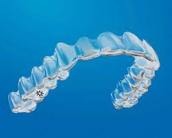 Invisalign Treatment - Preventive care is the foundation of a healthy smile. From cleanings to fillings and crowns, we keep your smile strong. Invisalign Treatment - Preventive care is the foundation of a healthy smile. From cleanings to fillings and crowns, we keep your smile strong.