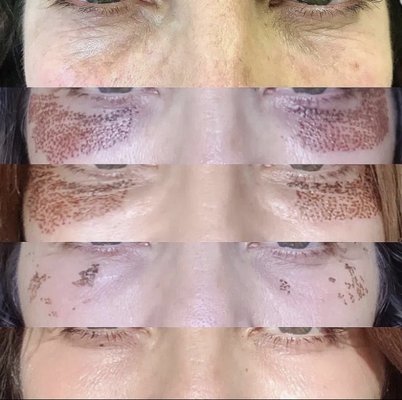 Halo Haus of Beauty - All of these treatments are performed by Michelle, the licensed aesthetician at The Aesthetics Lab Halo Haus of Beauty - All of these treatments are performed by Michelle, the licensed aesthetician at The Aesthetics Lab