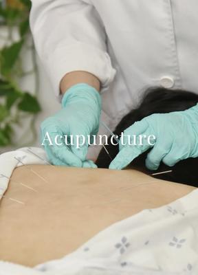 Acupuncture - Get a full-body Acupuncture treatment after a thorough consultation with our Director of Chinese Medicine & Acupuncture.
