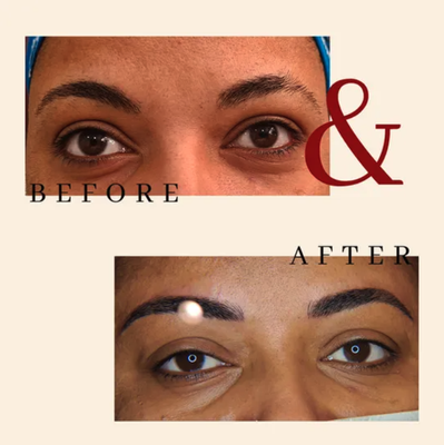 Microblading - Microblading

Microblading is a cosmetic tattooing procedure that fills in thin eyebrow areas to make them look fuller. Unlike a traditional tattoo, which is permanent, the coloring from microblading may last for up to 3 years. This is because microblading uses different tools and a smaller amount of pigment.

At Brazilian Hair Design we are fully invested in being masters of the art of microblading. With many years of experience in the area, and always keeping our focus on learning more and more; we ensure our customers great satisfaction and beautiful long lasting results. 

Before booking your microblading appointment we do ask for all of our customers to come in for a complimentary consultation appointment; this will allow us to analyze your desired eyebrow shape, your eyebrow color and your skin type. It is important for us to gather all that information before we can move on to a microblading appointment. 

If you have any questions please reach our to us and book your consultation appointment!