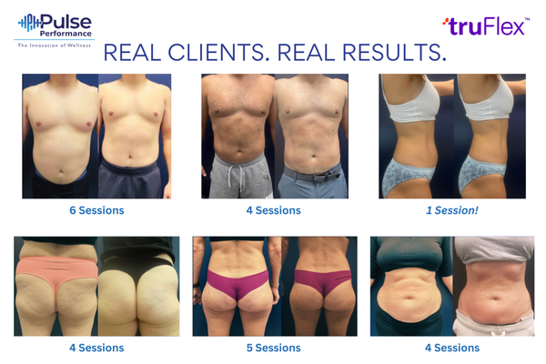 Body Contouring and Sculpting - Experience the future of non-invasive body contouring! Pulse offers 3 incredible services to help accelerate your fat-burning and muscle-building goals:
* TruFlex Body Sculpting - the newest and most advanced technology available, designed to help you achieve your body composition goals. This cutting-edge, non-invasive device harnesses the power of targeted electrical muscle stimulation (EMS) to help you achieve a sculpted physique faster and more effectively than traditional methods.
* Cavitation - Transform your body with Cavitation Therapy, a non-invasive, hassle less treatment that targets stubborn fat and cellulite using ultrasound technology. This revolutionary procedure breaks down fat cells, allowing your body to naturally eliminate them, revealing a slimmer, more sculpted figure. Say goodbye to stubborn fat and hello to effortless body contouring—no surgery, no downtime, just results!
* Vacuum Therapy - Enhance your curves and smooth your skin with Vacuum Therapy, a non-invasive treatment designed to lift, sculpt, and tone your body. Using advanced suction technology, this therapy stimulates circulation, boosts collagen production, and helps reduce cellulite for a firmer, more contoured look. Achieve natural-looking results without surgery or downtime—just a more confident you! Body Contouring and Sculpting - Experience the future of non-invasive body contouring! Pulse offers 3 incredible services to help accelerate your fat-burning and muscle-building goals:
* TruFlex Body Sculpting - the newest and most advanced technology available, designed to help you achieve your body composition goals. This cutting-edge, non-invasive device harnesses the power of targeted electrical muscle stimulation (EMS) to help you achieve a sculpted physique faster and more effectively than traditional methods.
* Cavitation - Transform your body with Cavitation Therapy, a non-invasive, hassle less treatment that targets stubborn fat and cellulite using ultrasound technology. This revolutionary procedure breaks down fat cells, allowing your body to naturally eliminate them, revealing a slimmer, more sculpted figure. Say goodbye to stubborn fat and hello to effortless body contouring—no surgery, no downtime, just results!
* Vacuum Therapy - Enhance your curves and smooth your skin with Vacuum Therapy, a non-invasive treatment designed to lift, sculpt, and tone your body. Using advanced suction technology, this therapy stimulates circulation, boosts collagen production, and helps reduce cellulite for a firmer, more contoured look. Achieve natural-looking results without surgery or downtime—just a more confident you!