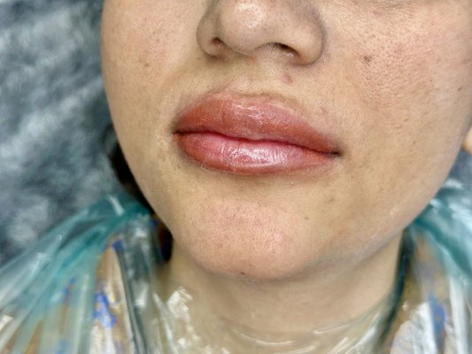 Lip Blushing - Our clients came to us looking for a natural enhancement of their lip color. Through professional lip blushing, we created soft, long-lasting pigmentation that beautifully complemented their features. After the treatment, their lips achieved a natural and elegant shade, providing a permanent touch of confidence and beauty. Lip Blushing - Our clients came to us looking for a natural enhancement of their lip color. Through professional lip blushing, we created soft, long-lasting pigmentation that beautifully complemented their features. After the treatment, their lips achieved a natural and elegant shade, providing a permanent touch of confidence and beauty.