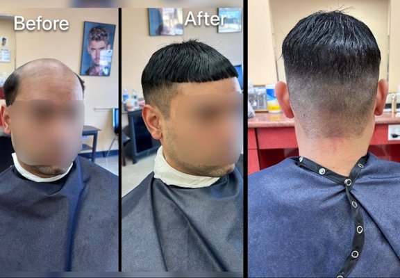 Our Results - Before and After Our Results - Before and After