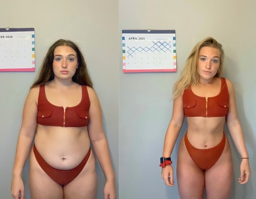 GLP-1 Semaglutide Weight Loss Treatments. - Come in and see why this newly FDA approved weight loss treatment is changing the lives of both our patients and staff! GLP-1 Semaglutide Weight Loss Treatments. - Come in and see why this newly FDA approved weight loss treatment is changing the lives of both our patients and staff!