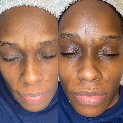 Exclusives Skin Bar - The Exclusives Hydrate Facial helps with refreshing dry and dehydrated skin. This includes a double cleanse, exfoliation of the top layer of skin, extractions if needed, as well as an intensive hydrating mask.