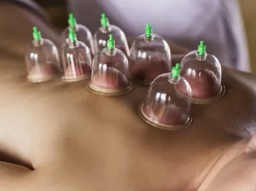 Cupping - Cupping

$20

Cupping is a type of alternative therapy that originated in China. It involves placing cups on the skin to create suction. The suction may facilitate healing with blood flow. When combined with massage therapy such as deep tissue massage, triggerpoint and Swedish massage, Cupping can provide more potential for pain relief.