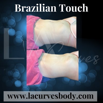 Body Contouring - is a type of Treatment focusing on stimulating the natural drainage of the lympth nodes, in order to eliminate waste and toxins from the body. Body Contouring - is a type of Treatment focusing on stimulating the natural drainage of the lympth nodes, in order to eliminate waste and toxins from the body.