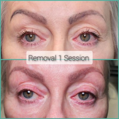 Lift Pigment Removal - Botched?  I can help! These are my clients results after 1 round of @liftpigmentremoval.
I specialize in corrections.  If you are seeking corrections come in for a free consultation so we can go over your options! 
💋Book your permanent makeup, aka cosmetic tattoo or free consult today! 🤗  Click the Linktree tab in my bio to book or for more information.