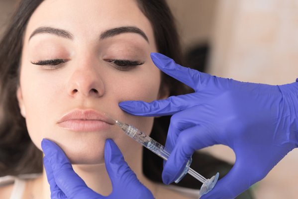Fillers - Hyaluronic acid (HA) and Calcium Hydroxylapatite (CaHa) can be used to restore volume lost, hydrate and add volume to lips, and smooth wrinkles and creases on the face. Fillers are used to enhance your natural features. Results are seen instantly and can last 6-18 months. Different types of fillers are used depending on client needs. Fillers - Hyaluronic acid (HA) and Calcium Hydroxylapatite (CaHa) can be used to restore volume lost, hydrate and add volume to lips, and smooth wrinkles and creases on the face. Fillers are used to enhance your natural features. Results are seen instantly and can last 6-18 months. Different types of fillers are used depending on client needs.