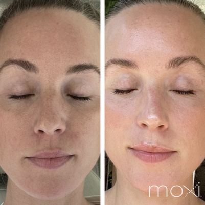 NUDE MEDICAL AESTHETICS - Updated December 2025 - 17 Photos & 13