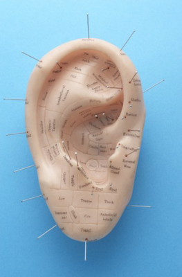 Auricular Acupuncture - This service involves a Traditional Chinese Medicine evaluation, followed by acupuncture which is administered only in the ears.