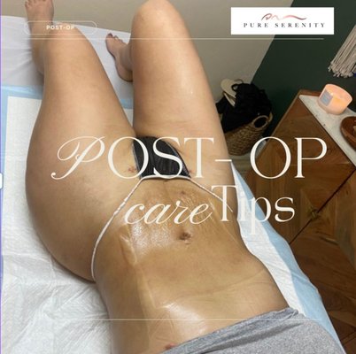 Post op - Remember to receive proper post op care after your surgery for faster healing. Post op - Remember to receive proper post op care after your surgery for faster healing.