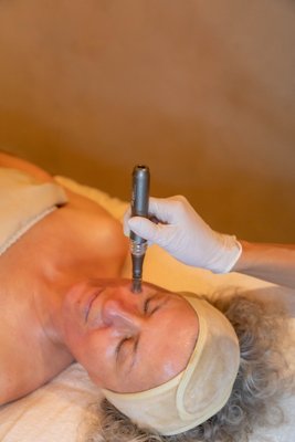 Microneedling - Microneedling Near me Miami—Are you ready to rejuvenate? Zeugma Spa is your new top Microneedling provider, offering clients cutting-edge technology, highly qualified and experienced skin care professionals, a luxurious spa experience, and most importantly, dramatic results! Microneedling - Microneedling Near me Miami—Are you ready to rejuvenate? Zeugma Spa is your new top Microneedling provider, offering clients cutting-edge technology, highly qualified and experienced skin care professionals, a luxurious spa experience, and most importantly, dramatic results!