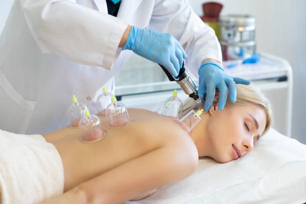 Cupping - cupping treatment involves cups on the skin, created by either heating a glass cup or using a pump to remove air from a plastic cup to creates a localized stretch .to relief pain, reduced muscle tension, increased blood flow, help to remove stagnant blood and break up fascial adhesions improved range of motion Cupping - cupping treatment involves cups on the skin, created by either heating a glass cup or using a pump to remove air from a plastic cup to creates a localized stretch .to relief pain, reduced muscle tension, increased blood flow, help to remove stagnant blood and break up fascial adhesions improved range of motion
