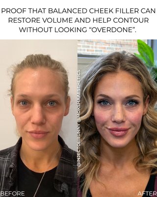 Before & After - Before and Afters