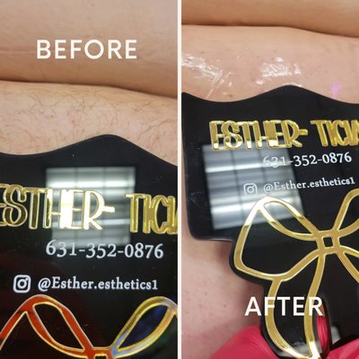 Brazilian wax - Before & After a Brazilian Wax:
With consistent care, this smooth and beautiful result can be yours too!