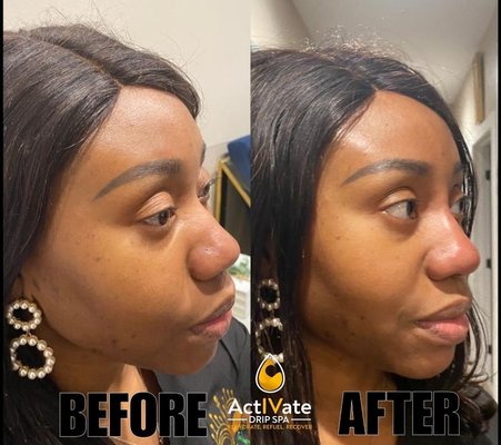 Aesthetics - Botox & Fillers - We tailor services to fit your needs so that your skin's health will continue to improve over time.